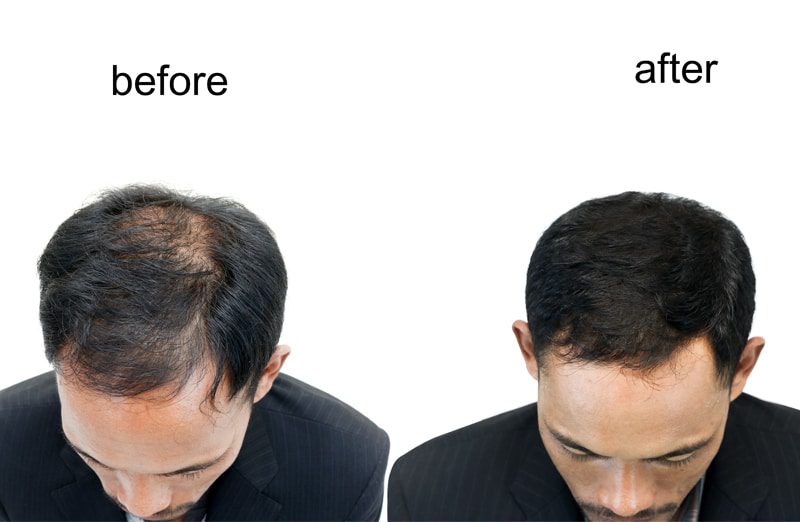 trichologist london hair loss london service image 4